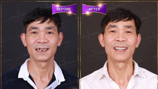 Slider image (2) Worldwide Dental & Cosmetic Surgery Hospital